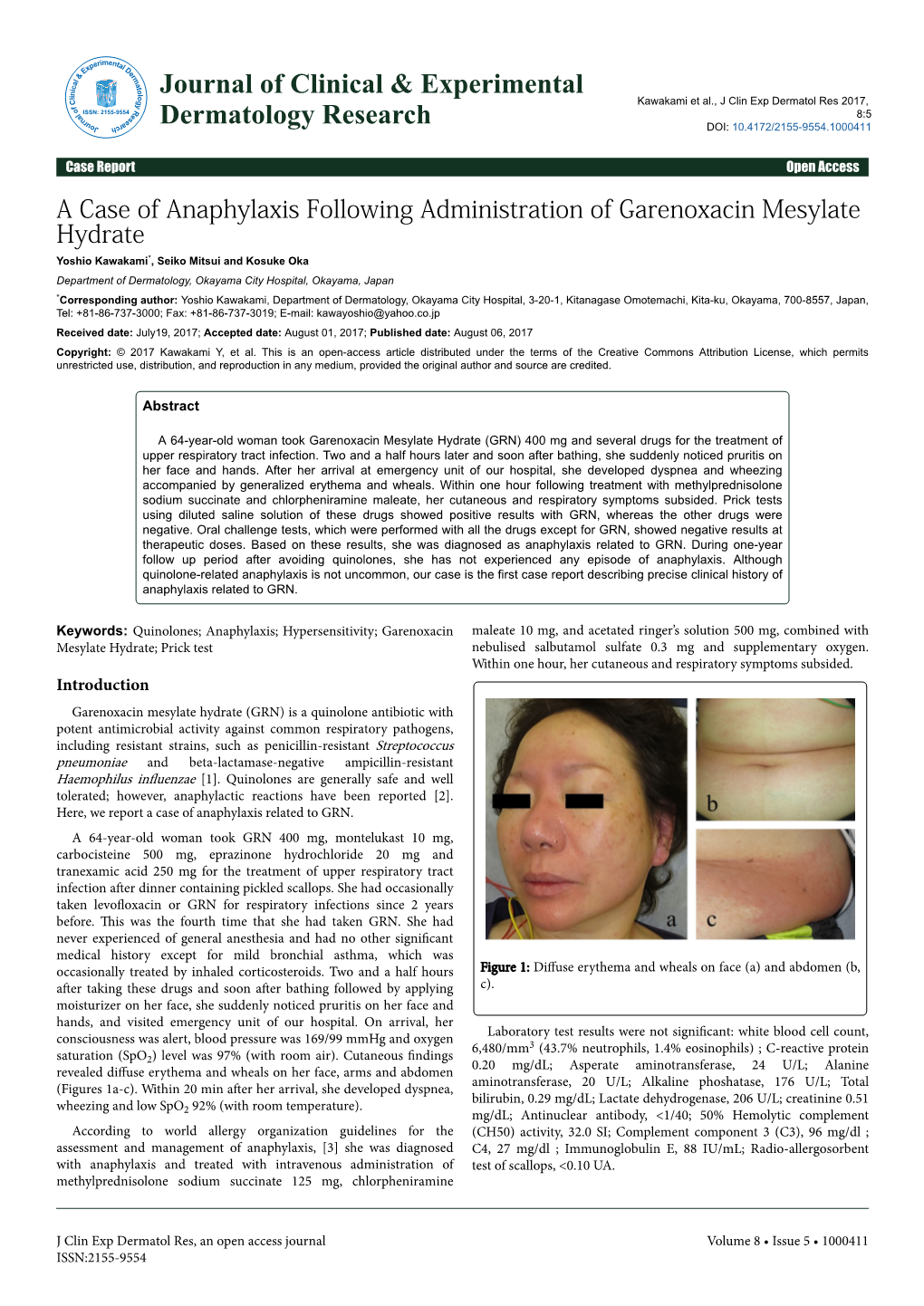 A Case of Anaphylaxis Following Administration of Garenoxacin