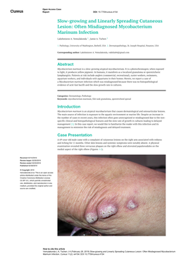 Often Misdiagnosed Mycobacterium Marinum Infection