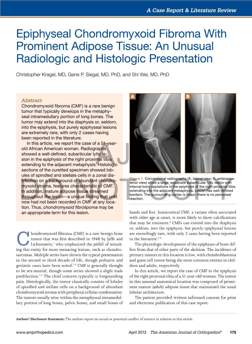 Epiphyseal Chondromyxoid Fibroma with Prominent Adipose Tissue: an Unusual Radiologic and Histologic Presentation