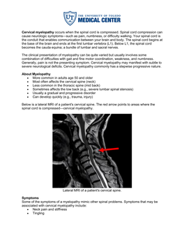 Cervical Myelopathy Occurs When the Spinal Cord Is Compressed. Spinal Cord Compression Can Cause Neurologic Symptoms—Such As Pain, Numbness, Or Difficulty Walking