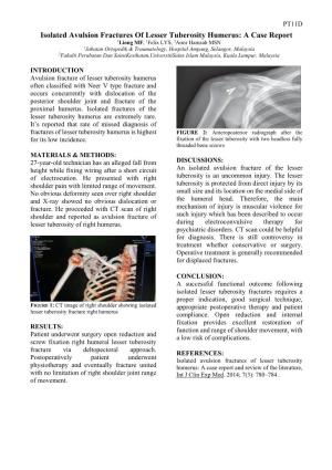 Isolated Avulsion Fractures of Lesser Tuberosity Humerus: a Case Report