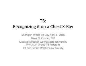 TB: Recognizing It on a Chest X-Ray