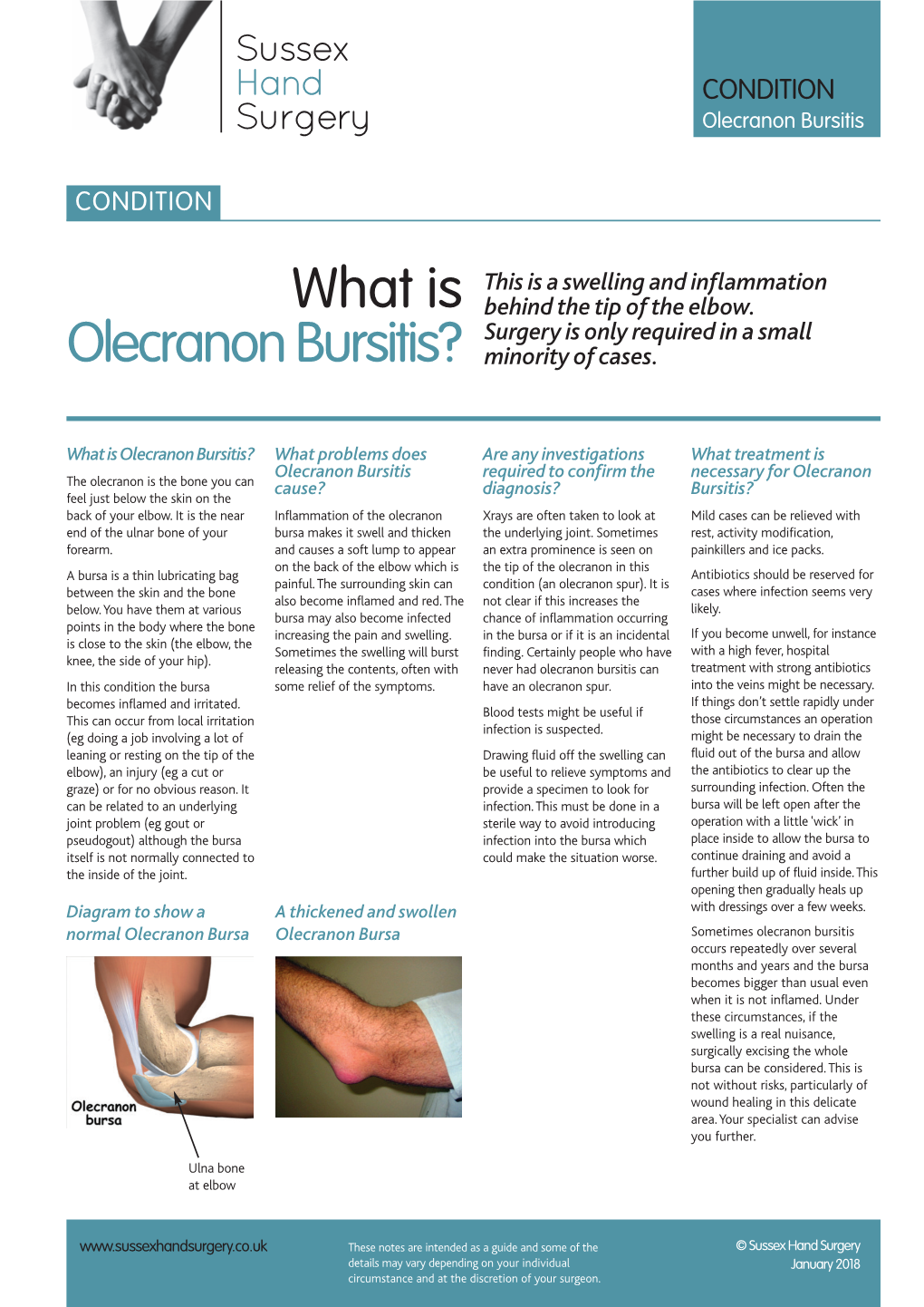 What Is Olecranon Bursitis?