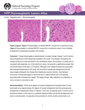 Liver, Hepatocyte – Karyomegaly