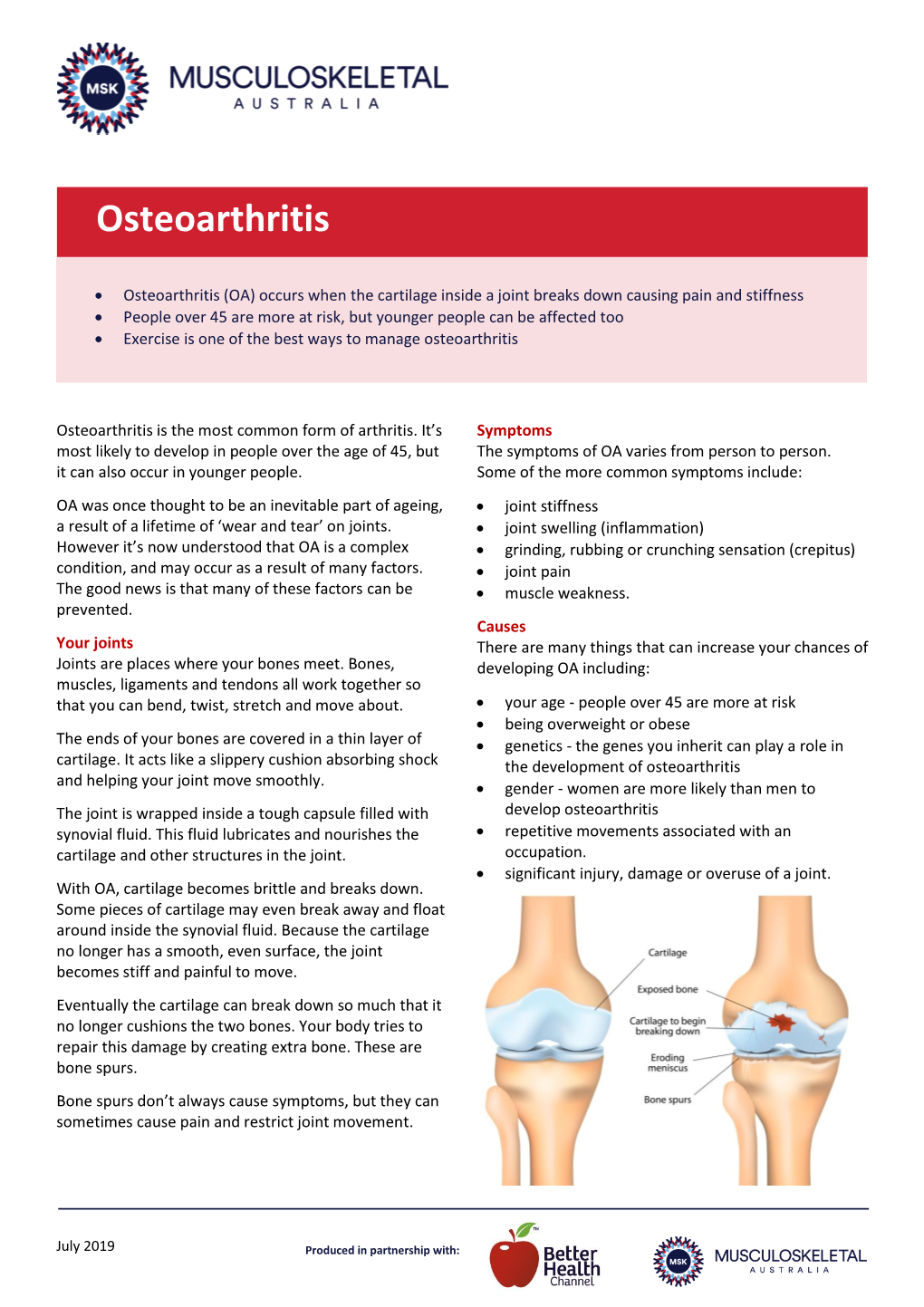 Osteoarthritis