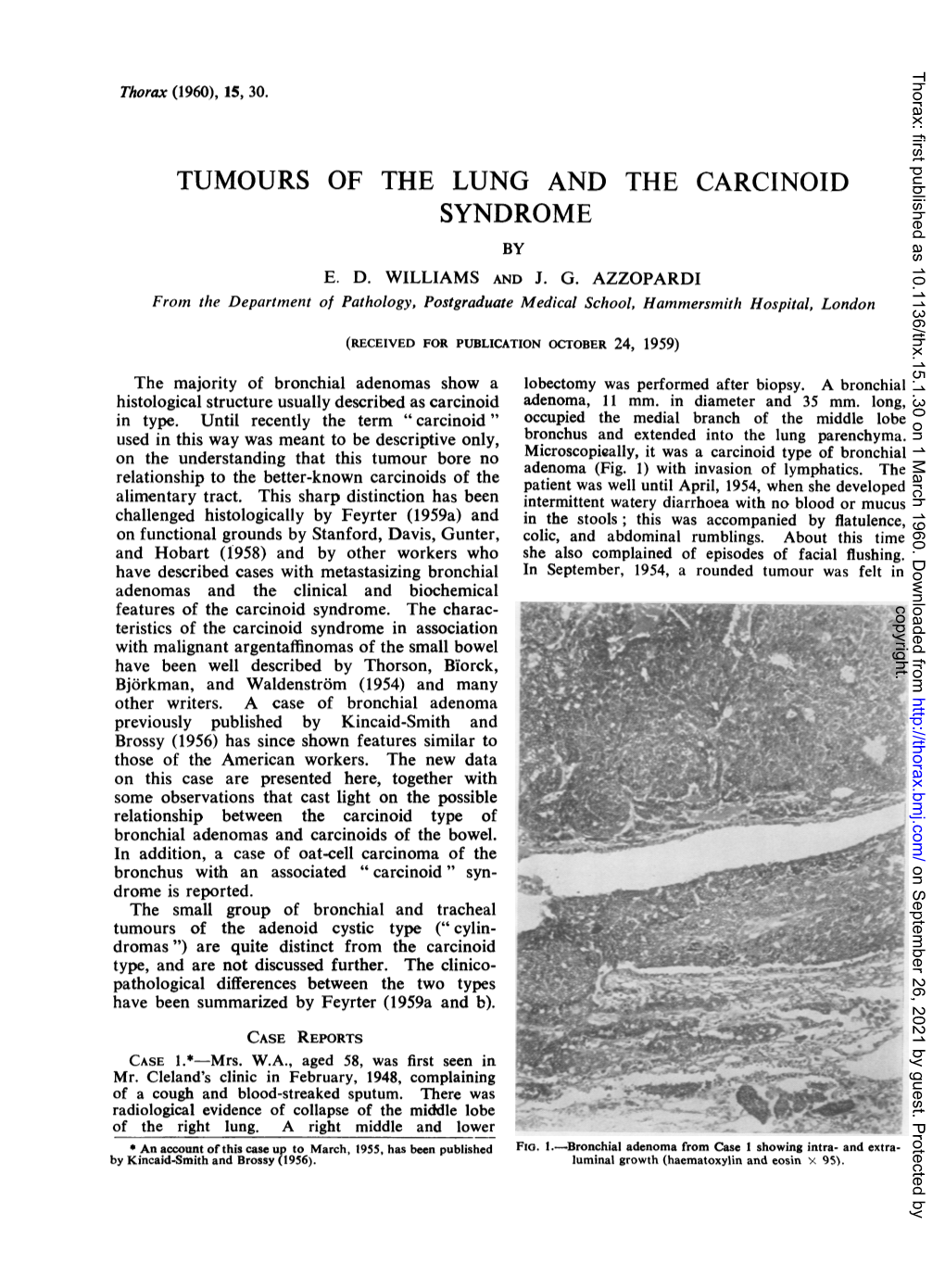 Tumours of the Lung and the Carcinoid Syndrome by E