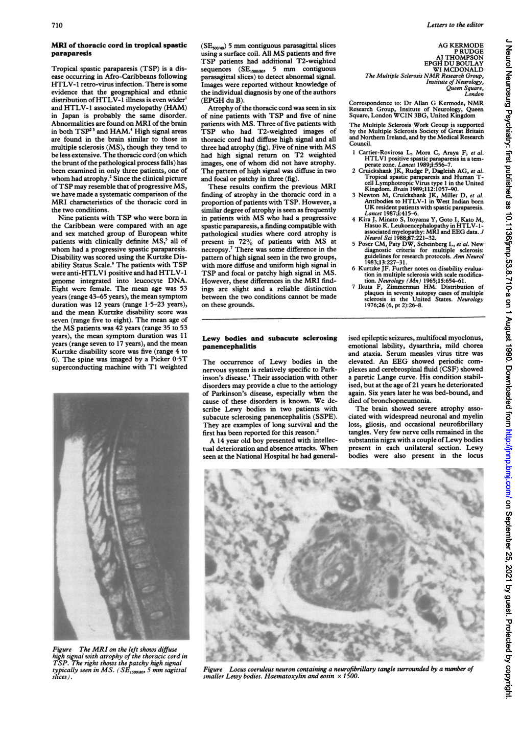 Typically Seen in MS. (SE,,00180,5 Mm Sagittal