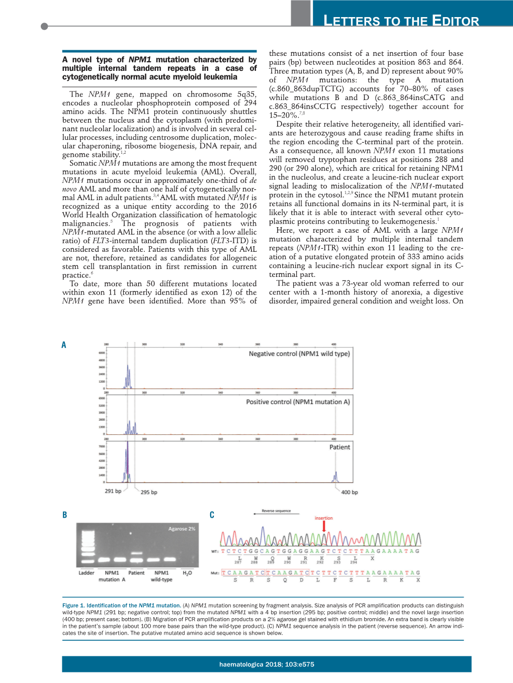 A Novel Type of NPM1 Mutation Characterized by Multiple Internal Tandem Repeats in a Case of Cytogenetically Normal Acute Myeloi