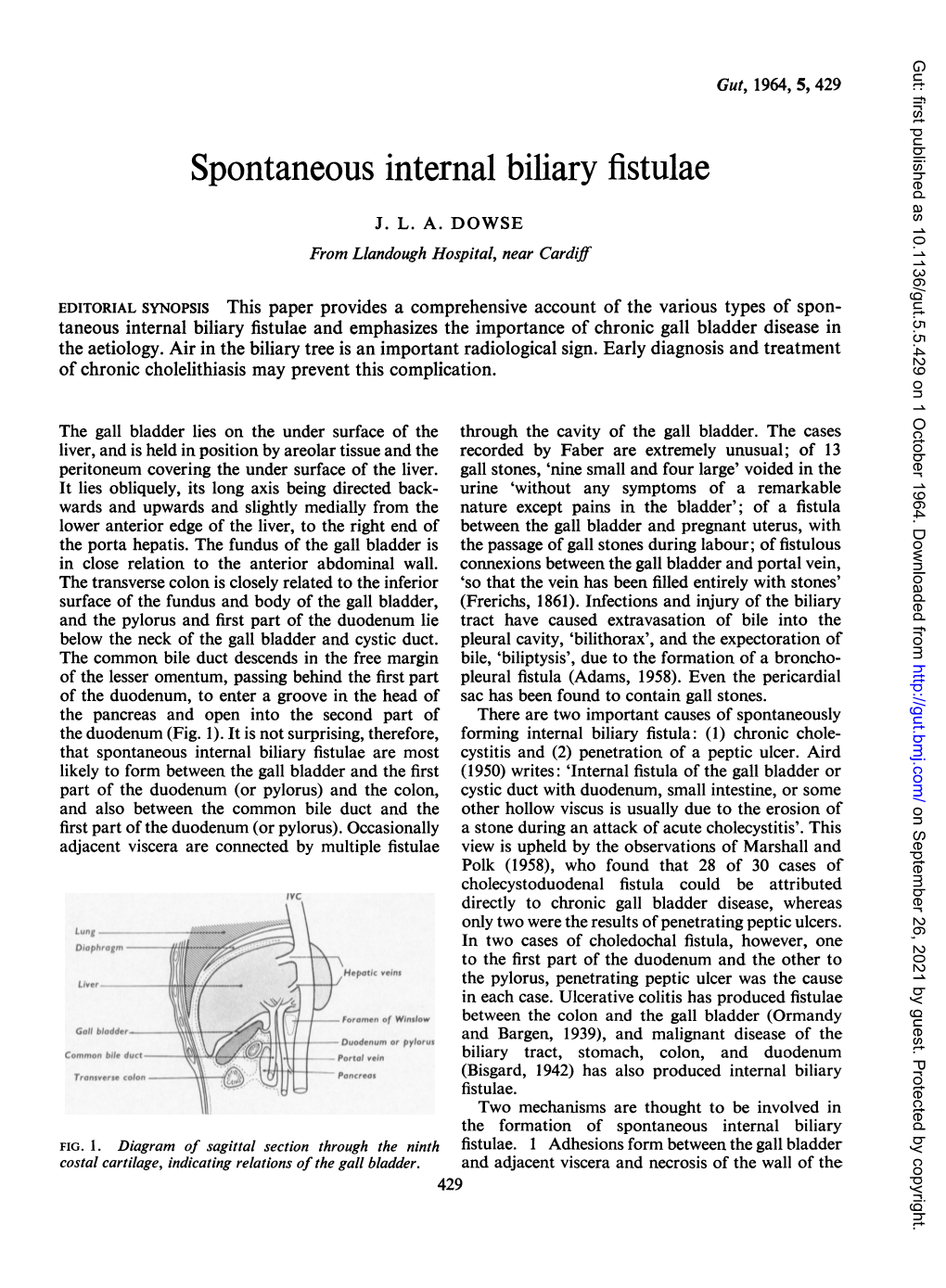 Spontaneous Internal Biliary Fistulae