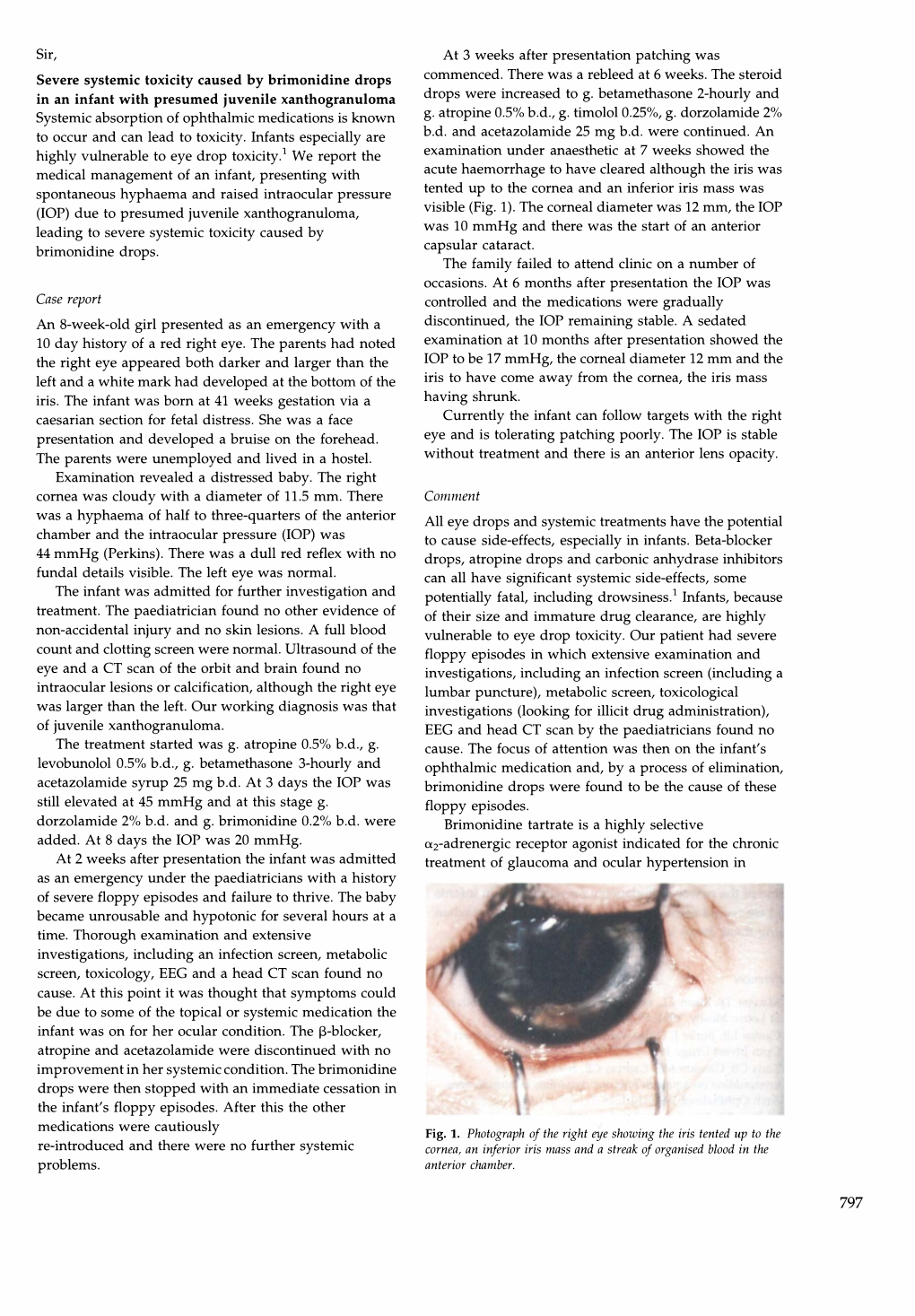 Severe Systemic Toxicity Caused by Brimonidine Drops in an Infant With