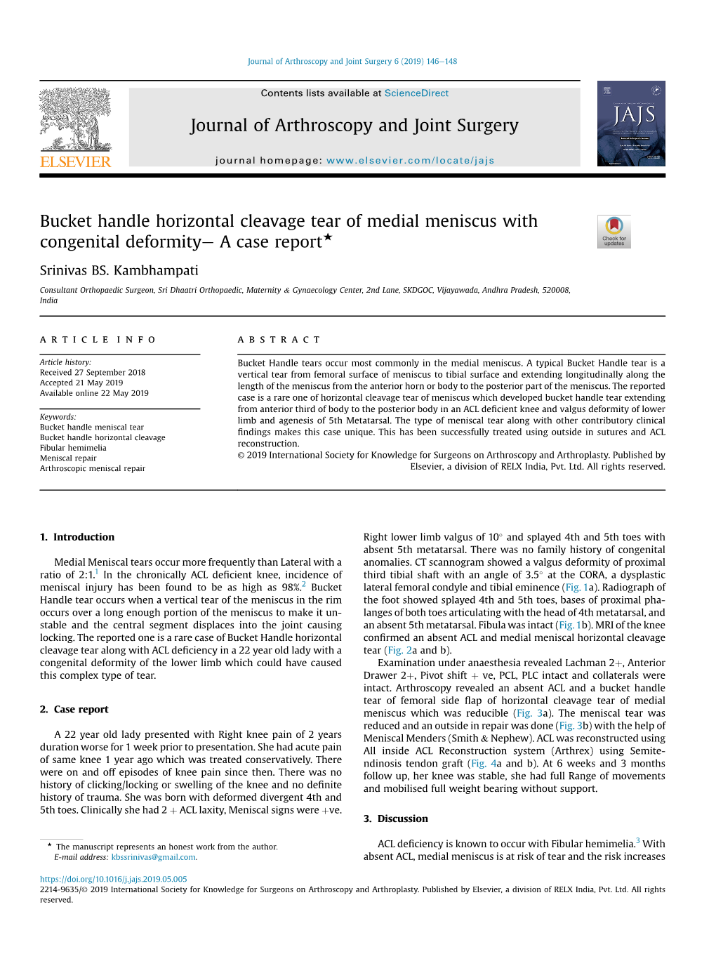 Bucket Handle Horizontal Cleavage Tear of Medial Meniscus with Congenital Deformitye a Case Report+