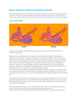 Endolymphatic Hydrops & Meniere's Disease The