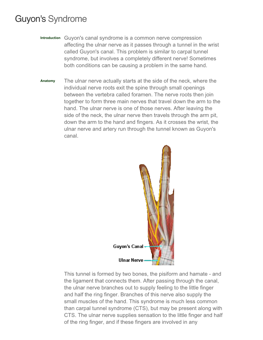 Guyon's Canal Syndrome Is a Common Nerve Compression Affecting the Ulnar Nerve As It Passes Through a Tunnel in the Wrist Called Guyon's Canal