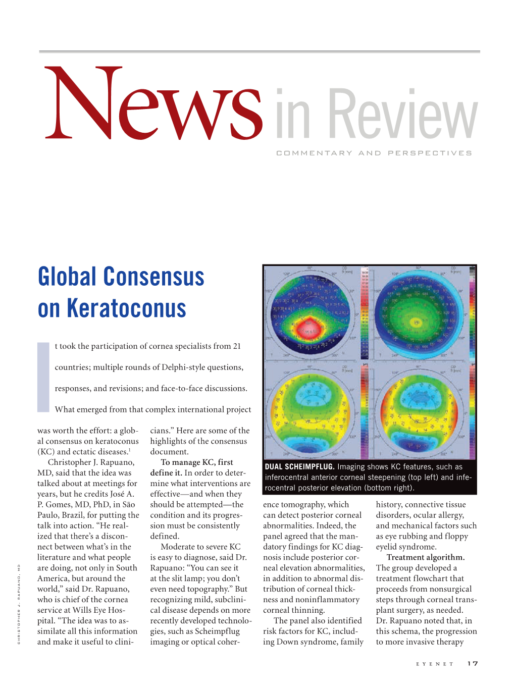 Global Consensus on Keratoconus