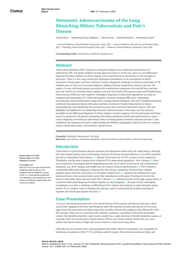 Metastatic Adenocarcinoma of the Lung Mimicking Miliary Tuberculosis and Pott’S Disease