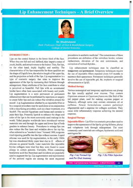 Lip Enhancement Techniques Man Be Classified As Characteristics of the Lips Responsible for These Qualities Are Temporary and Permanent