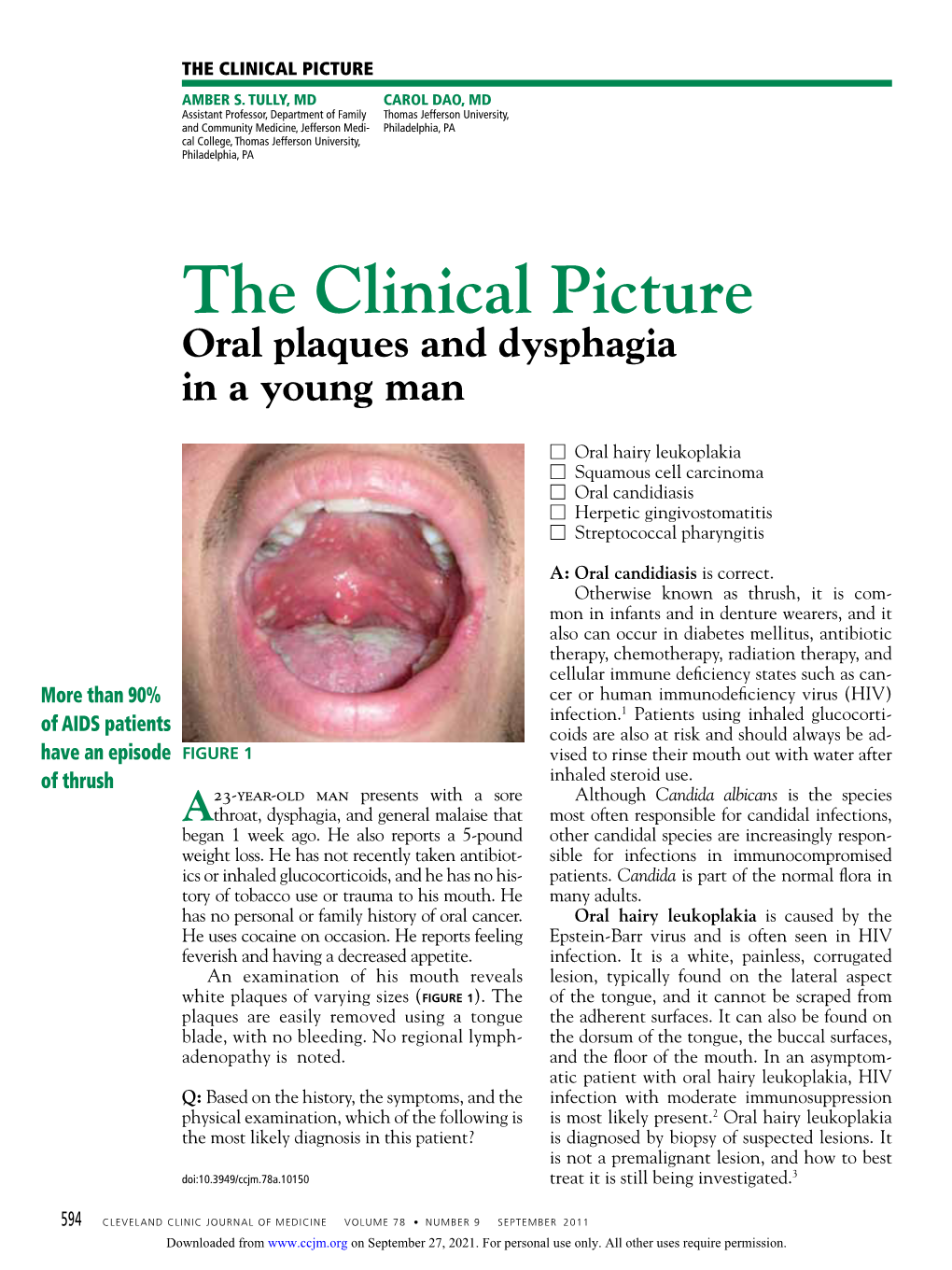 Oral Plaques and Dysphagia in a Young Man