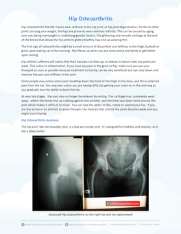 Hip Osteoarthritis