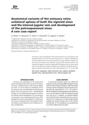 Anatomical Variants of the Emissary Veins: Unilateral Aplasia of Both the Sigmoid Sinus and the Internal Jugular Vein and Development of the Petrosquamosal Sinus