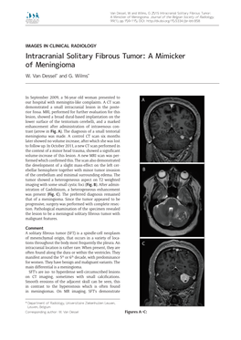 Intracranial Solitary Fibrous Tumor: a Mimicker of Meningioma