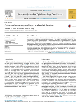 Cutaneous Horn Masquerading As a Seborrheic Keratosis