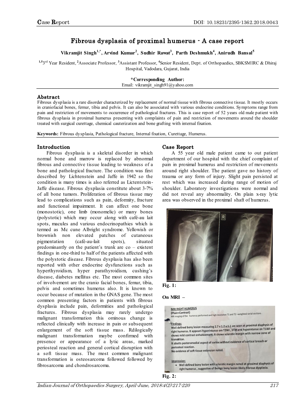 Fibrous Dysplasia of Proximal Humerus - a Case Report