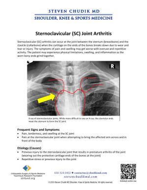 Sternoclavicular (SC) Joint Arthritis