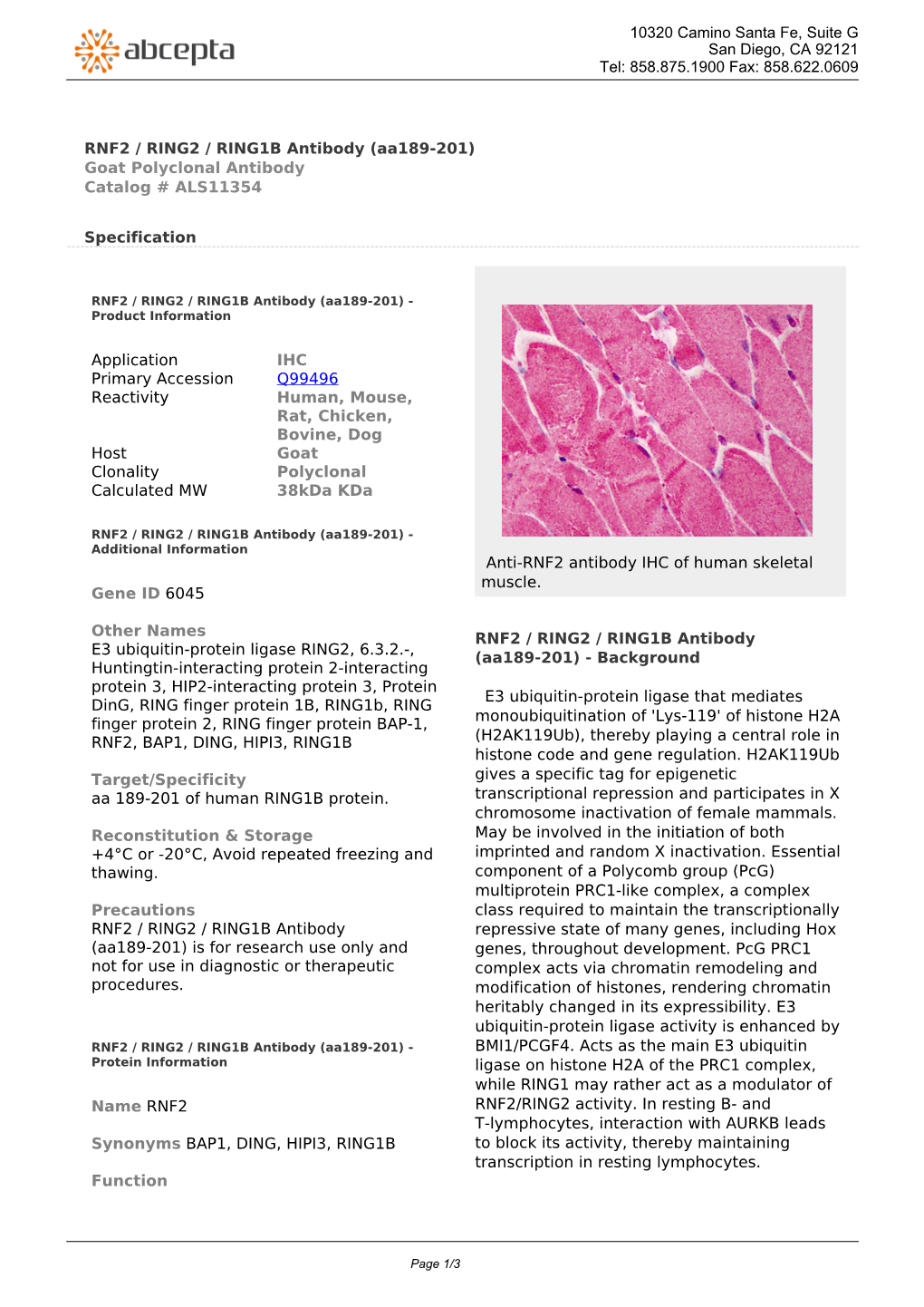 RNF2 / RING2 / RING1B Antibody (Aa189-201) Goat Polyclonal Antibody Catalog # ALS11354