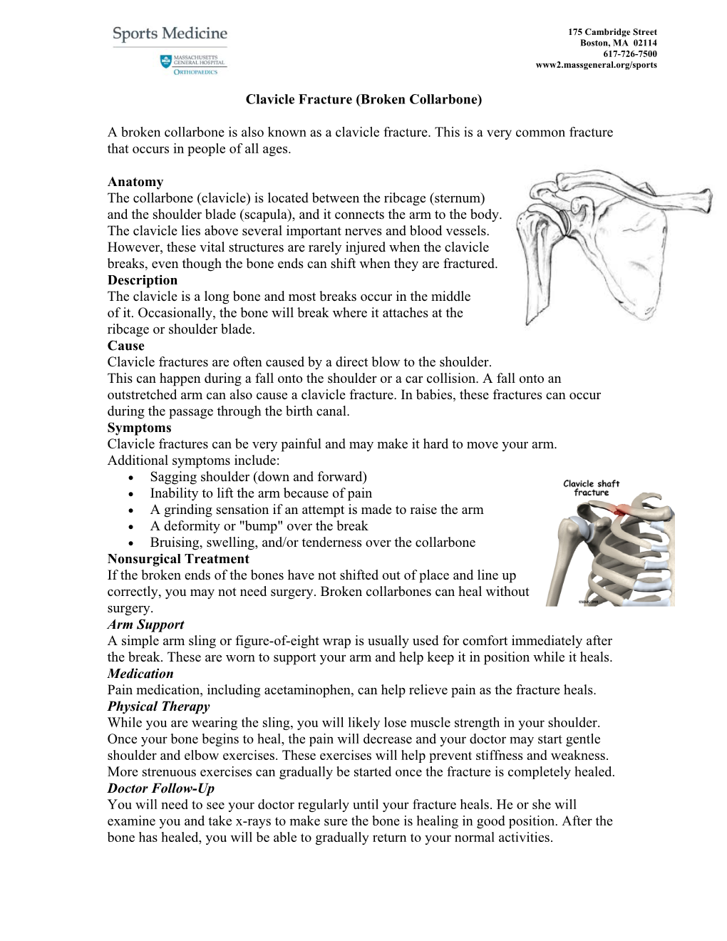 Clavicle Fracture (Broken Collarbone)