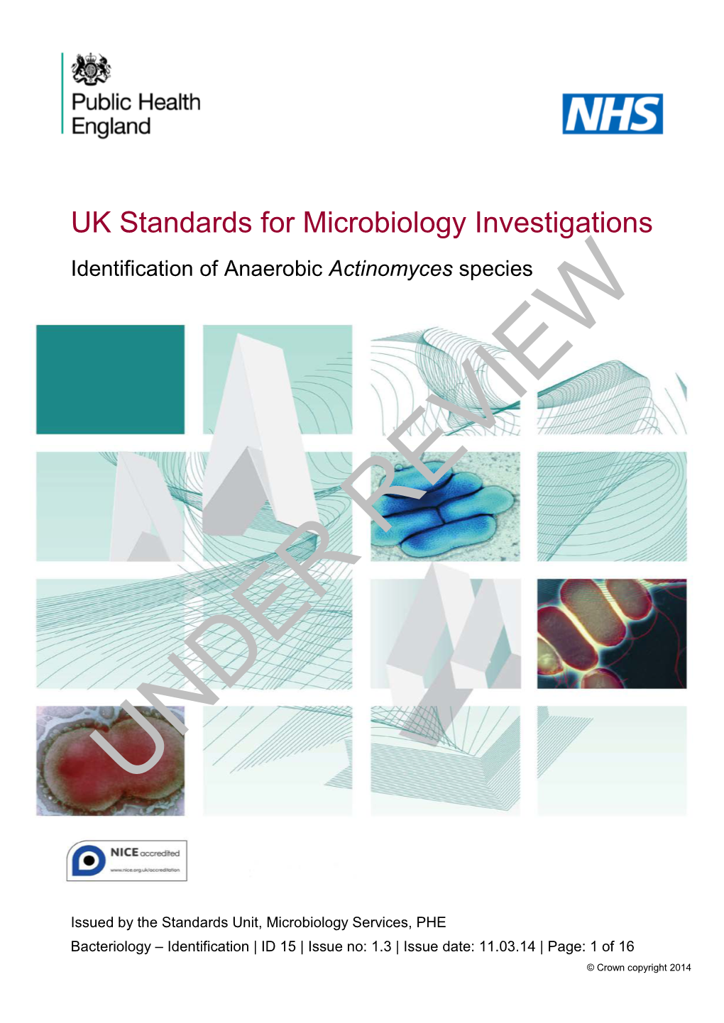 Identification of Anaerobic Actinomyces Species