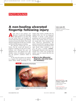 A Non-Healing Ulcerated Fingertip Following Injury