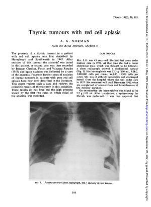 Thymic Tumours with Red Cell Aplasia