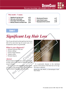 Significant Leg Hair Loss P.33 1