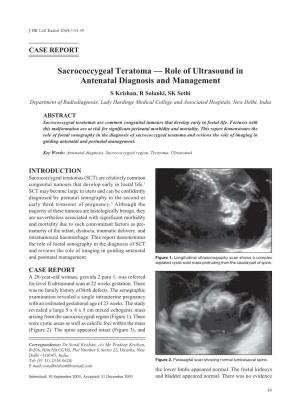 Sacrococcygeal Teratoma — Role of Ultrasound in Antenatal Diagnosis