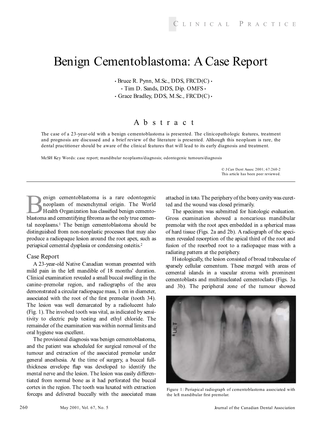 Benign Cementoblastoma: a Case Report