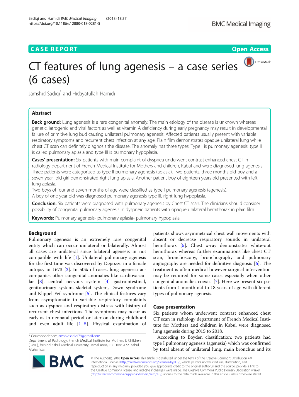 CT Features of Lung Agenesis – a Case Series (6 Cases) Jamshid Sadiqi* and Hidayatullah Hamidi