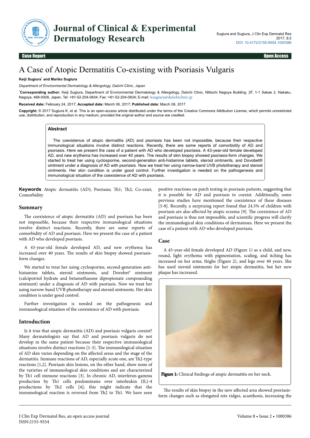 A Case of Atopic Dermatitis Co-Existing with Psoriasis Vulgaris