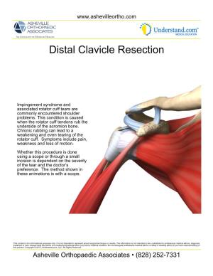 Distal Clavicle Resection