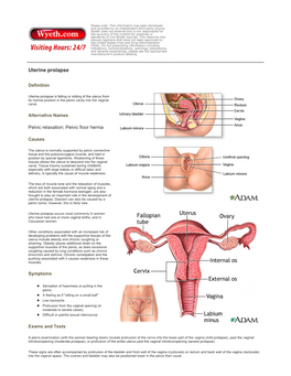 Uterine Prolapse