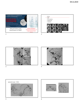 Natural History and Classification of Davf Second Case: SHA 1 2 3 4