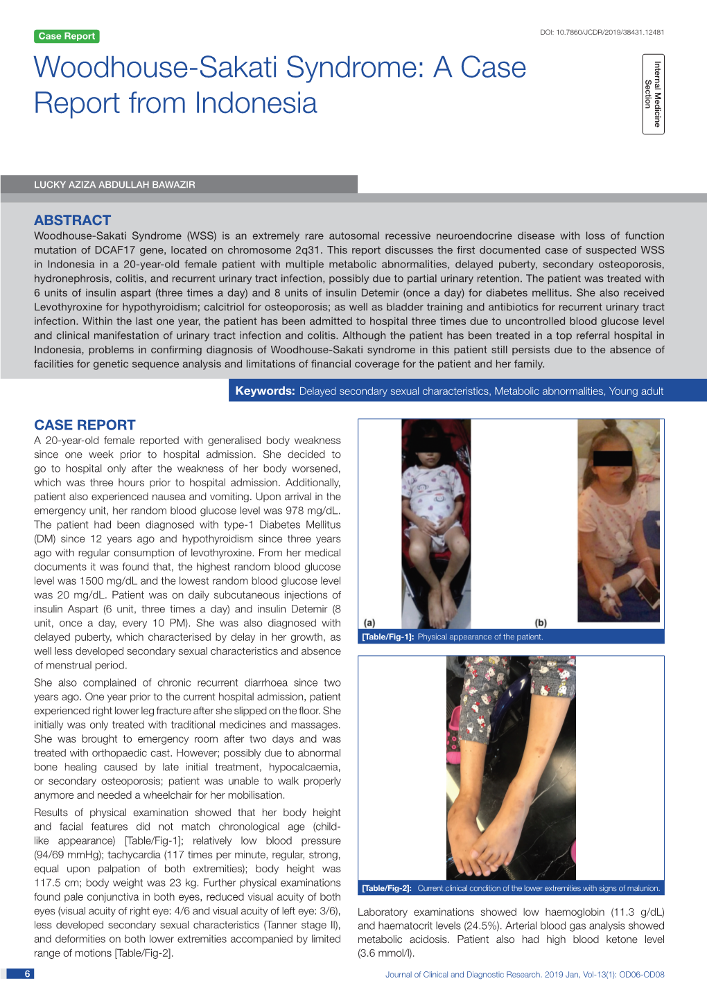 Woodhouse-Sakati Syndrome: a Case Report from Indonesia