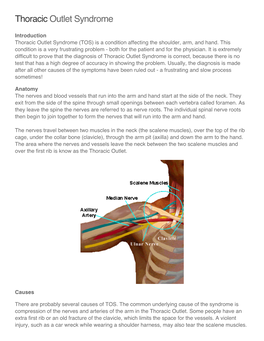 Thoracic Outlet Syndrome