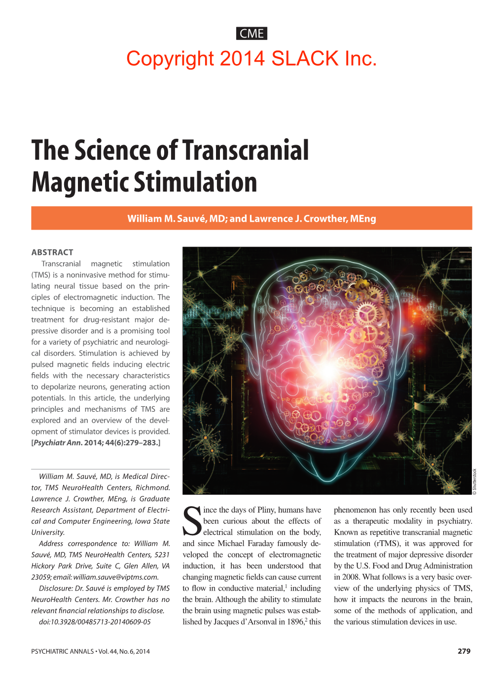 The Science of Transcranial Magnetic Stimulation