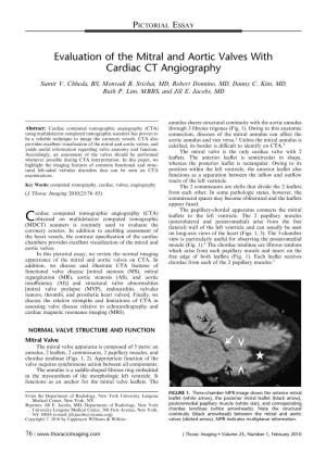 Evaluation of the Mitral and Aortic Valves with Cardiac CT Angiography