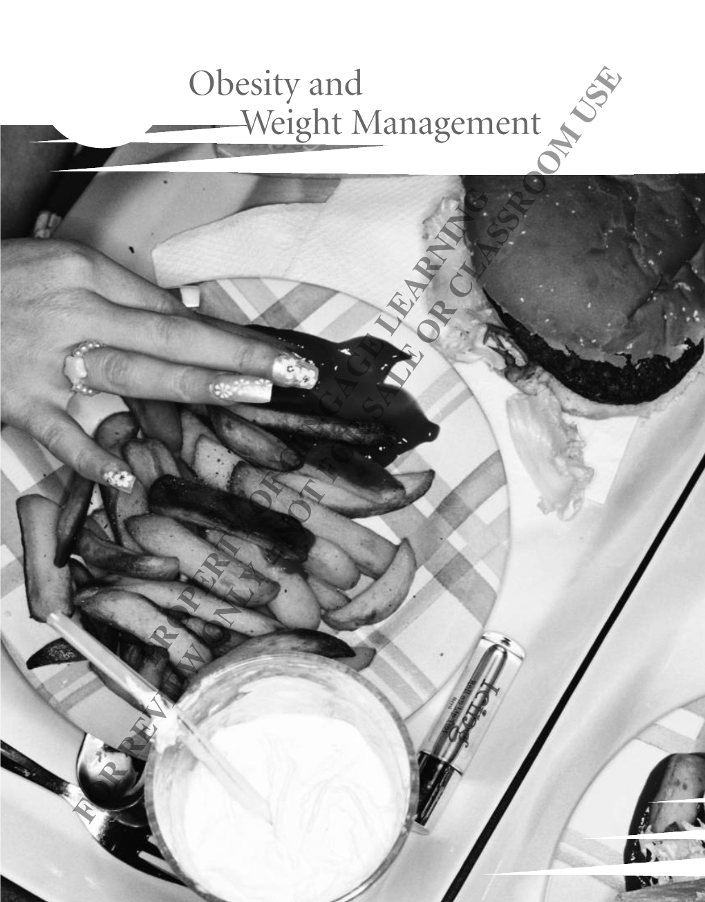 Obesity and Weight Management