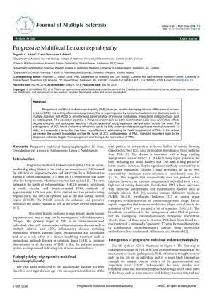 Progressive Multifocal Leukoencephalopathy Reginald C