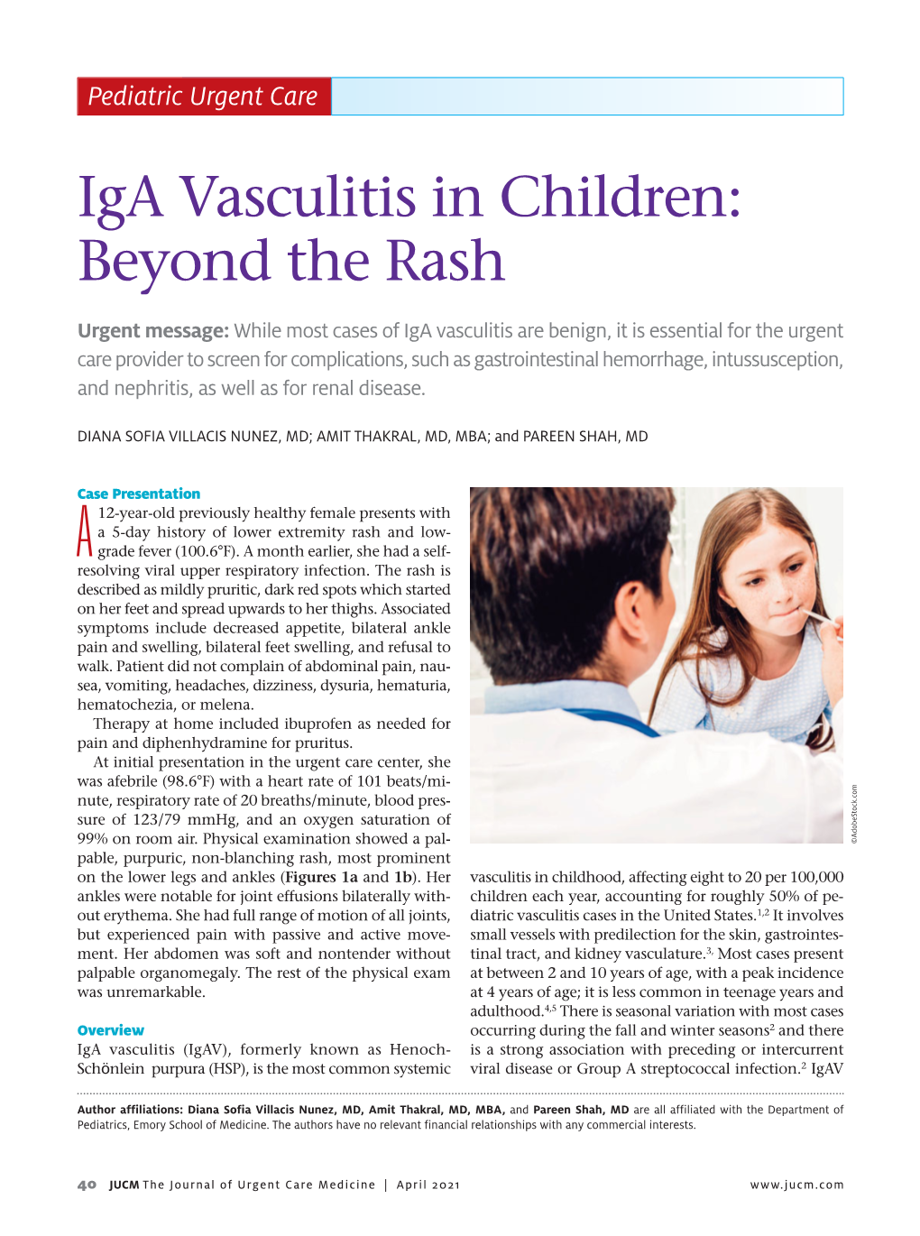 Iga Vasculitis in Children: Beyond the Rash