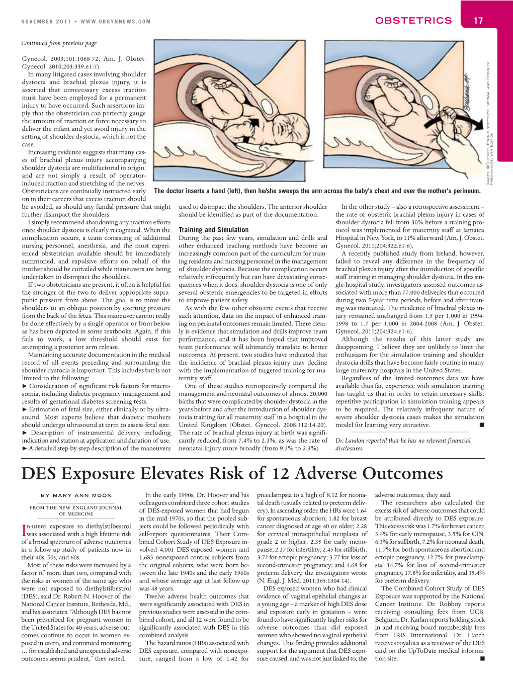 DES Exposure Elevates Risk of 12 Adverse Outcomes