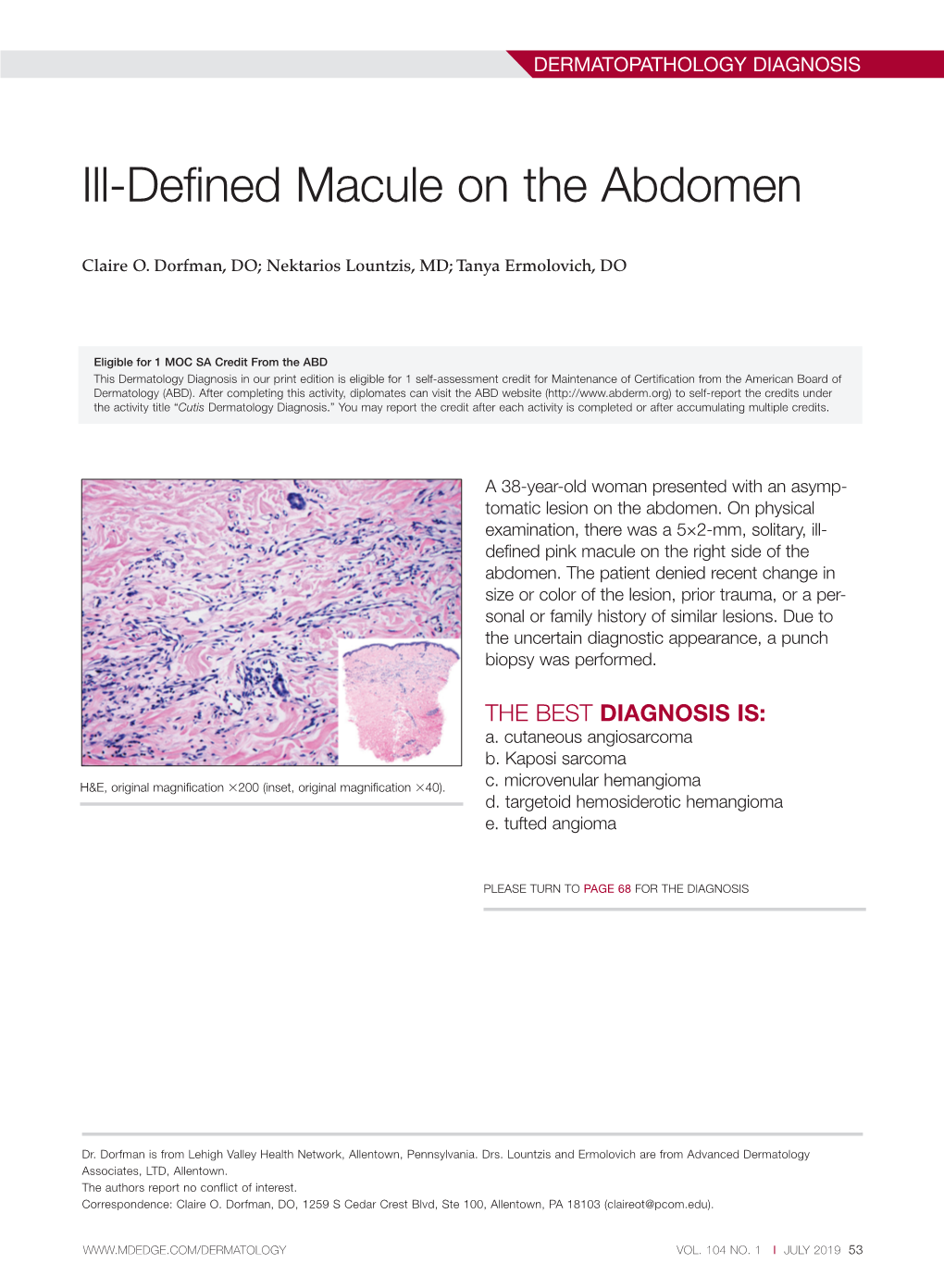 Ill-Defined Macule on the Abdomen