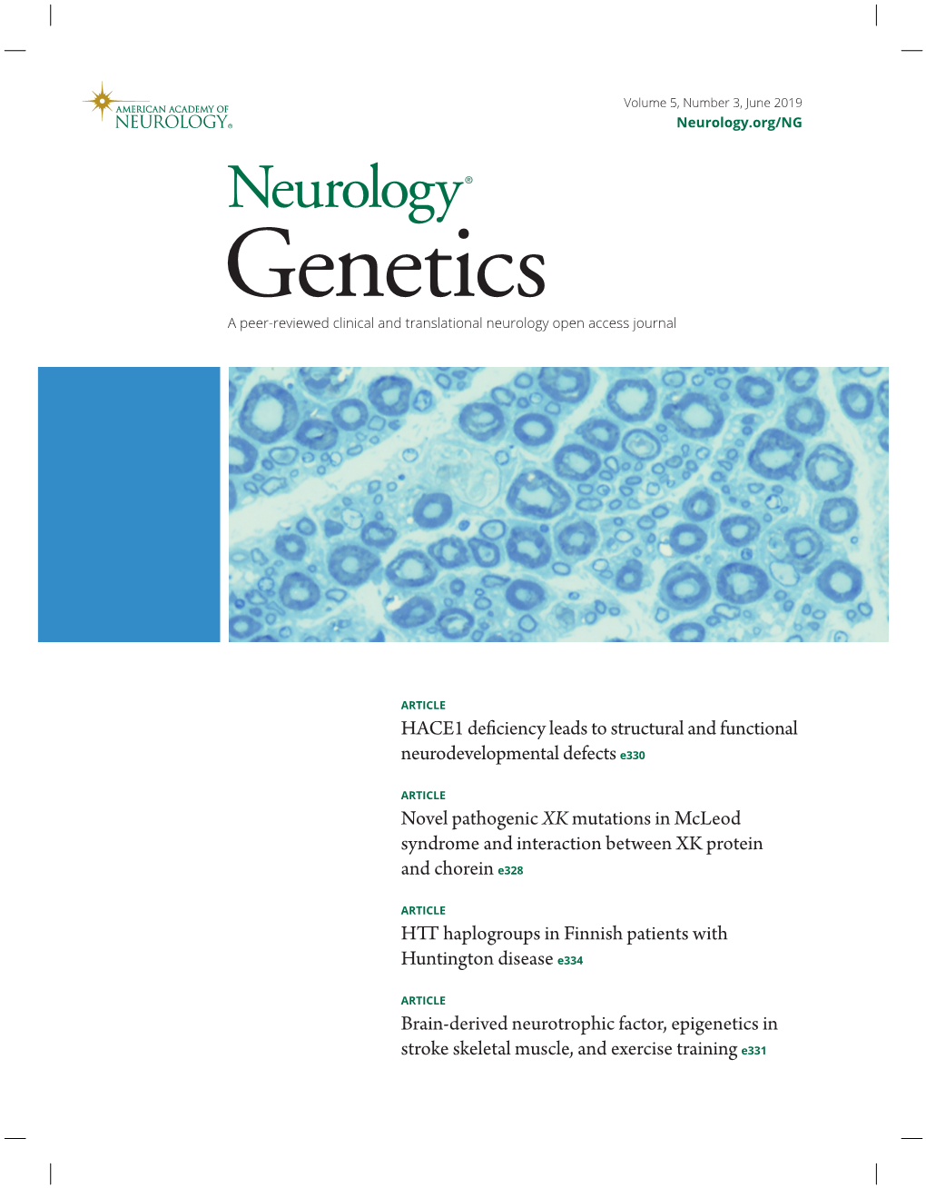 HACE1 Deficiency Leads to Structural and Functional Neurodevelopmental